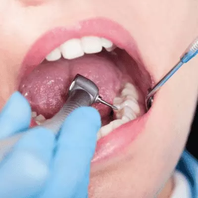 Traitement dentaire